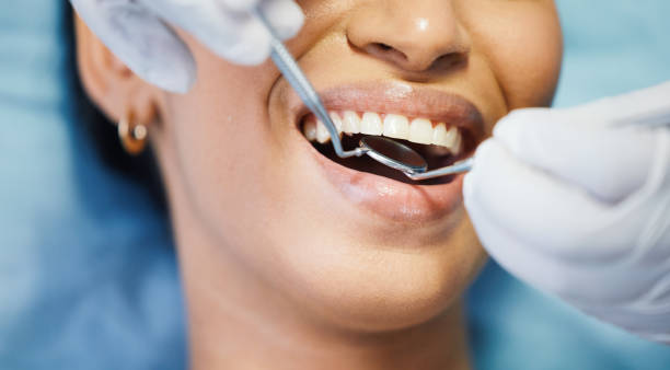 Best Emergency Dentist for Knocked-Out Tooth in Chelan, WA